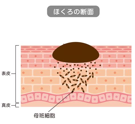 クリトリスほくろについて 